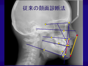 審美的矯正治療02