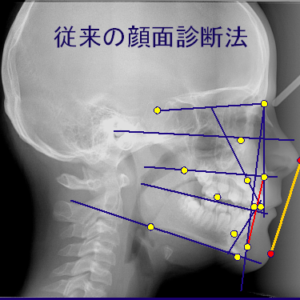 審美的矯正治療