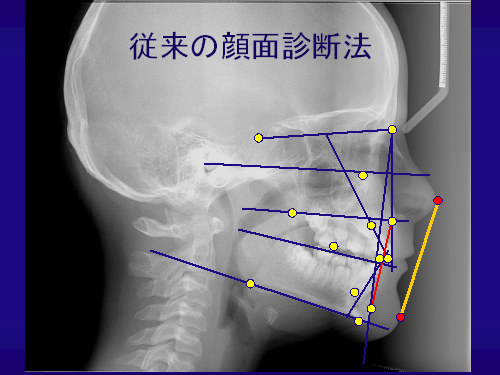 審美的矯正治療